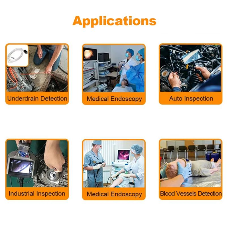 2.25MP OCH2B10 USB2.0 UVC Endoscope Camera Module with 1500×1500 Resolution and 140° Wide Angle